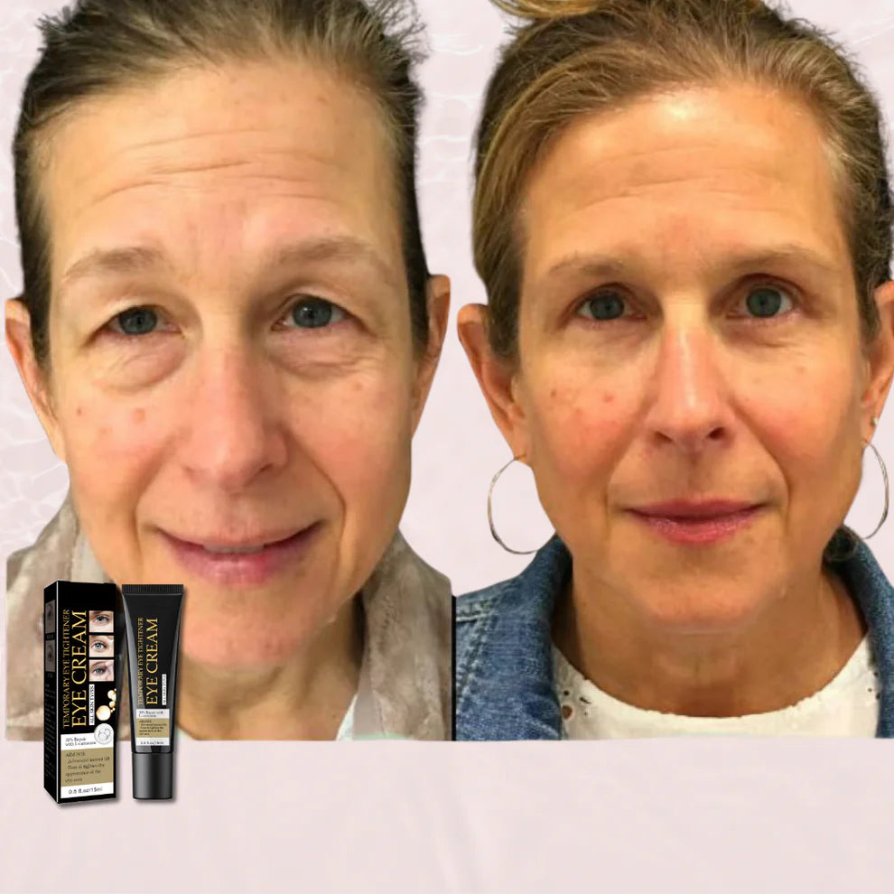 Face Tightening + Eyebag Removal Cream