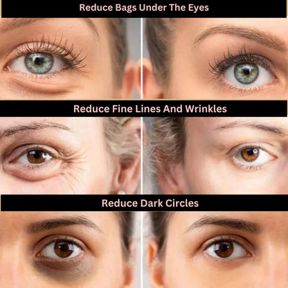Face Tightening + Eyebag Removal Cream