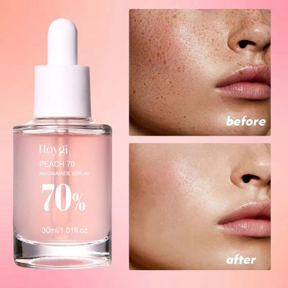 30Ml Niacinamide Serum