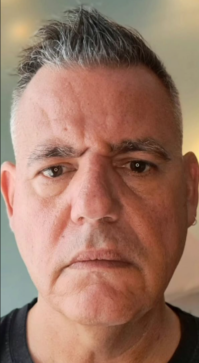 Before using Face Tightening + Eyebag Removal Cream