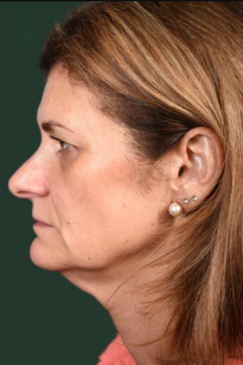 Before using UV Neck & Face Massager