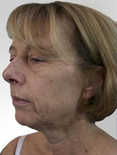 Before using UV Neck & Face Massager