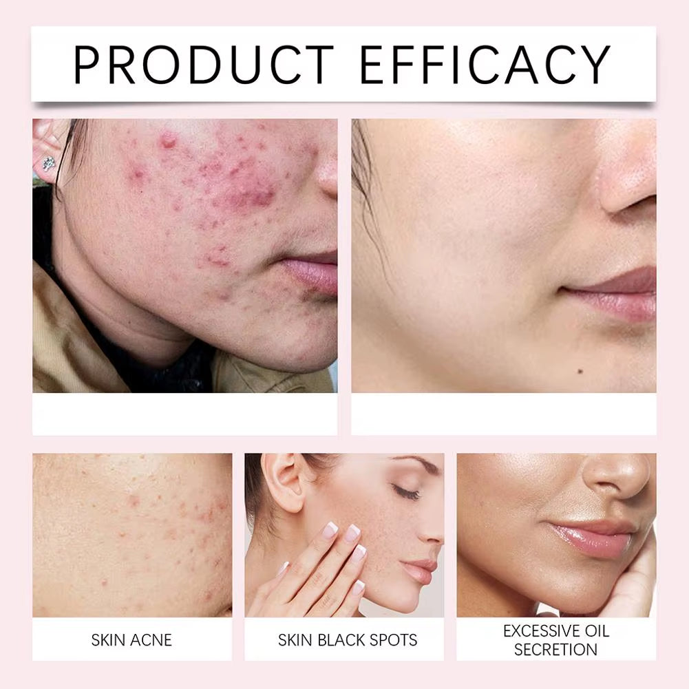 40Pcs Turmeric Kojic Acid Cleansing Pads Exfoliating Pads Facial Sponges for Cleansing Exfoliating Daily Cleaning Skin Care